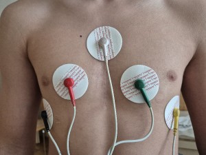 ekg-holter.jpg